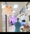 家用308准分子激光怎么选最好